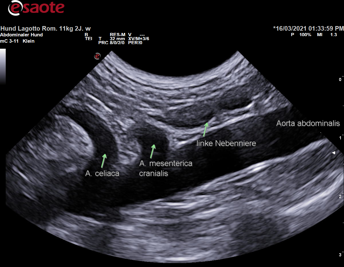 Darstellung des Abgangs der Arteria celiaca aus der Aorta abdominalis im B-Bild mit Beschriftung