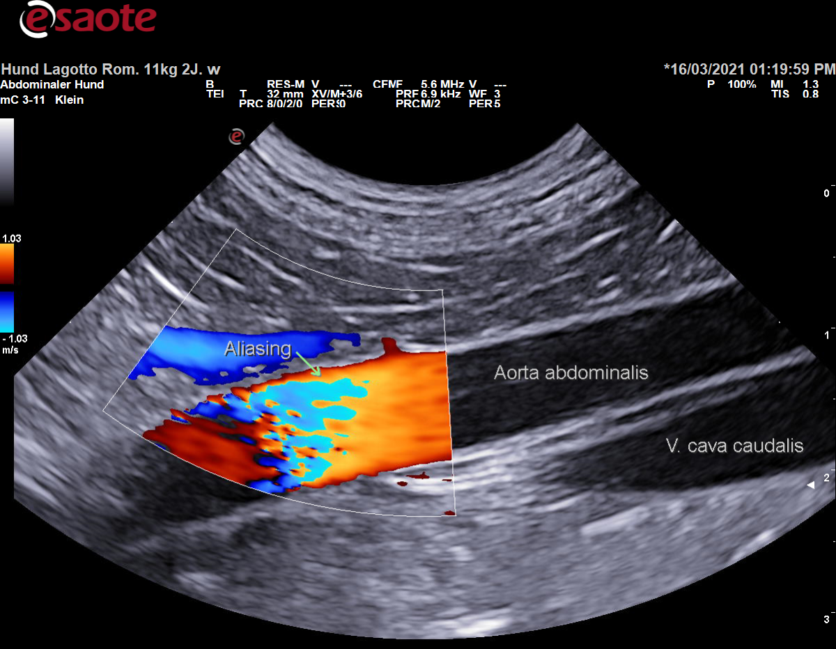 Aliasing bei Anwendung des Fabdopplers am Beispiel der Aorta abdominalis