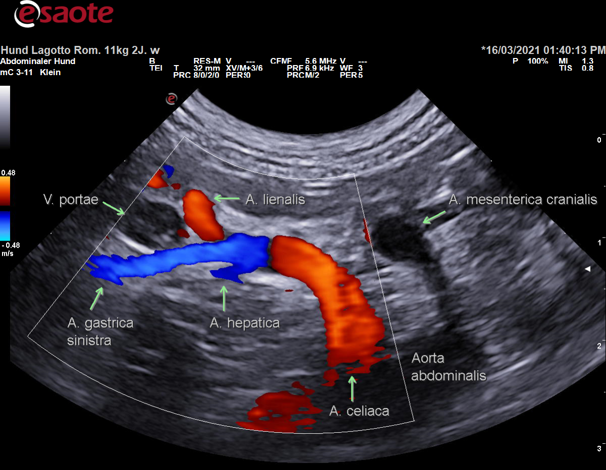 Darstellung der Arteria celiaca und ihrer Äste im Farbdoppler mit Beschriftung