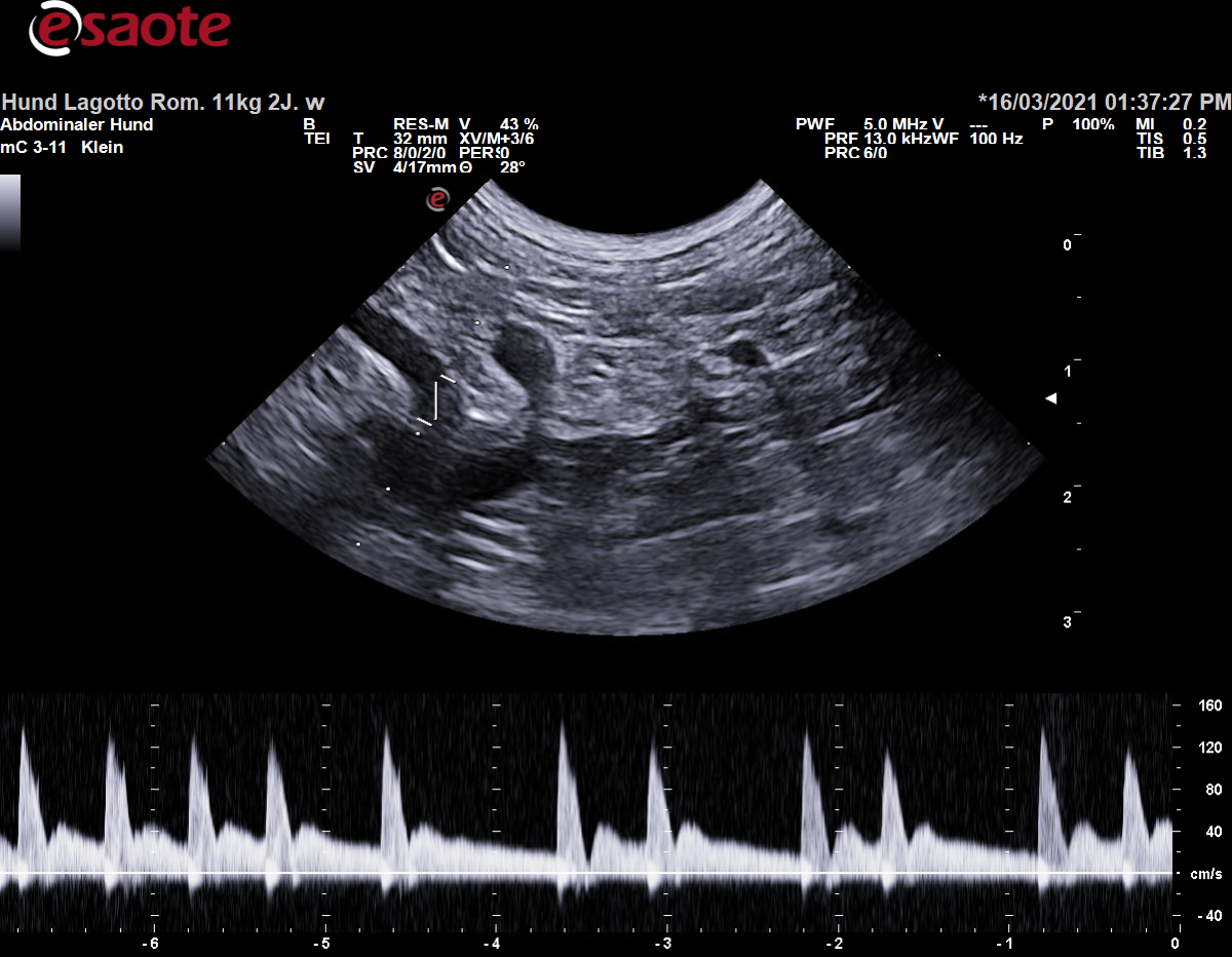 Koventionelle Duplexsonographie der Arteria celiaca mit dem PW-Doppler