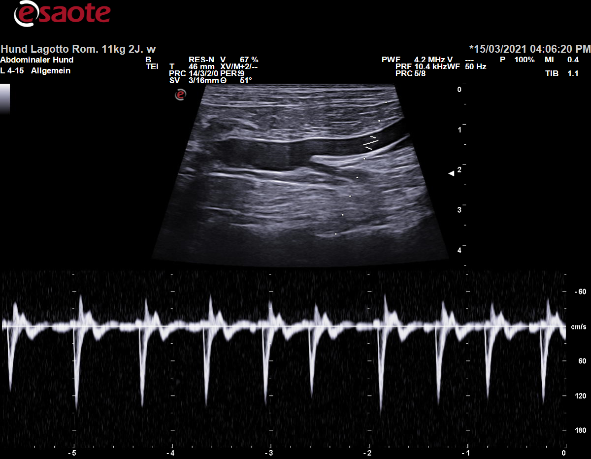 Koventionelle Duplexsonographie der Arteria iliaca externa sinistra mit dem PW-Doppler