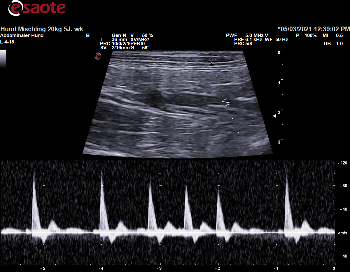 Koventionelle Duplexsonographie der Arteria iliaca interna sinistra mit dem PW-Doppler