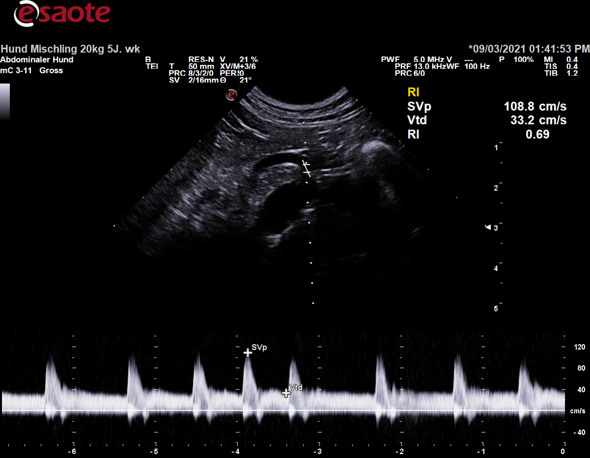 Koventionelle Duplexsonographie der Arteria renalis mit dem PW-Doppler & Ausmessung des RI