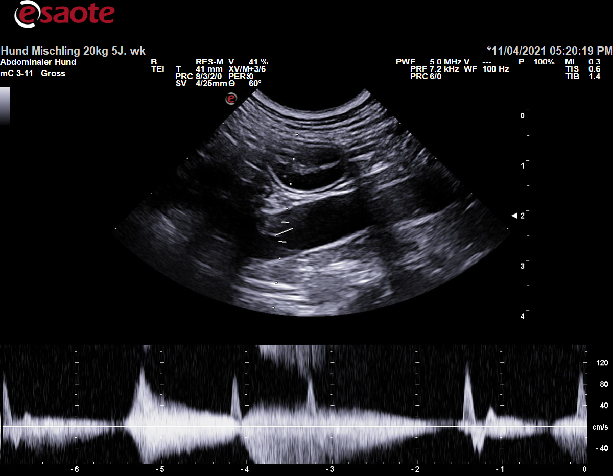 PW-Doppler am Beispiel der Aorta abdominalis mit Überlagerung des Dopplerspektrums durch Bewegungsartefakte