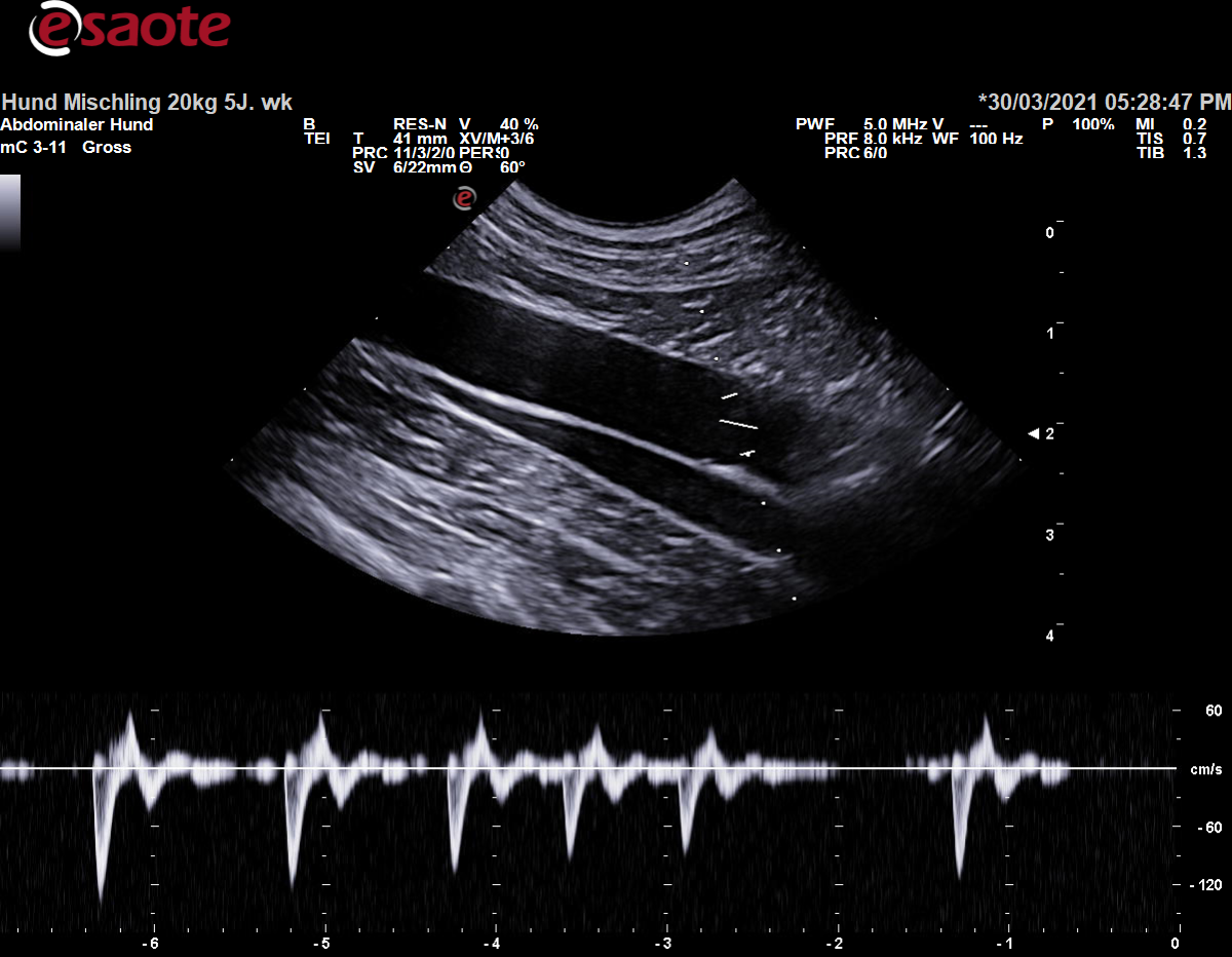 Konventionelle Duplexsonographie der Aorta abdominalis