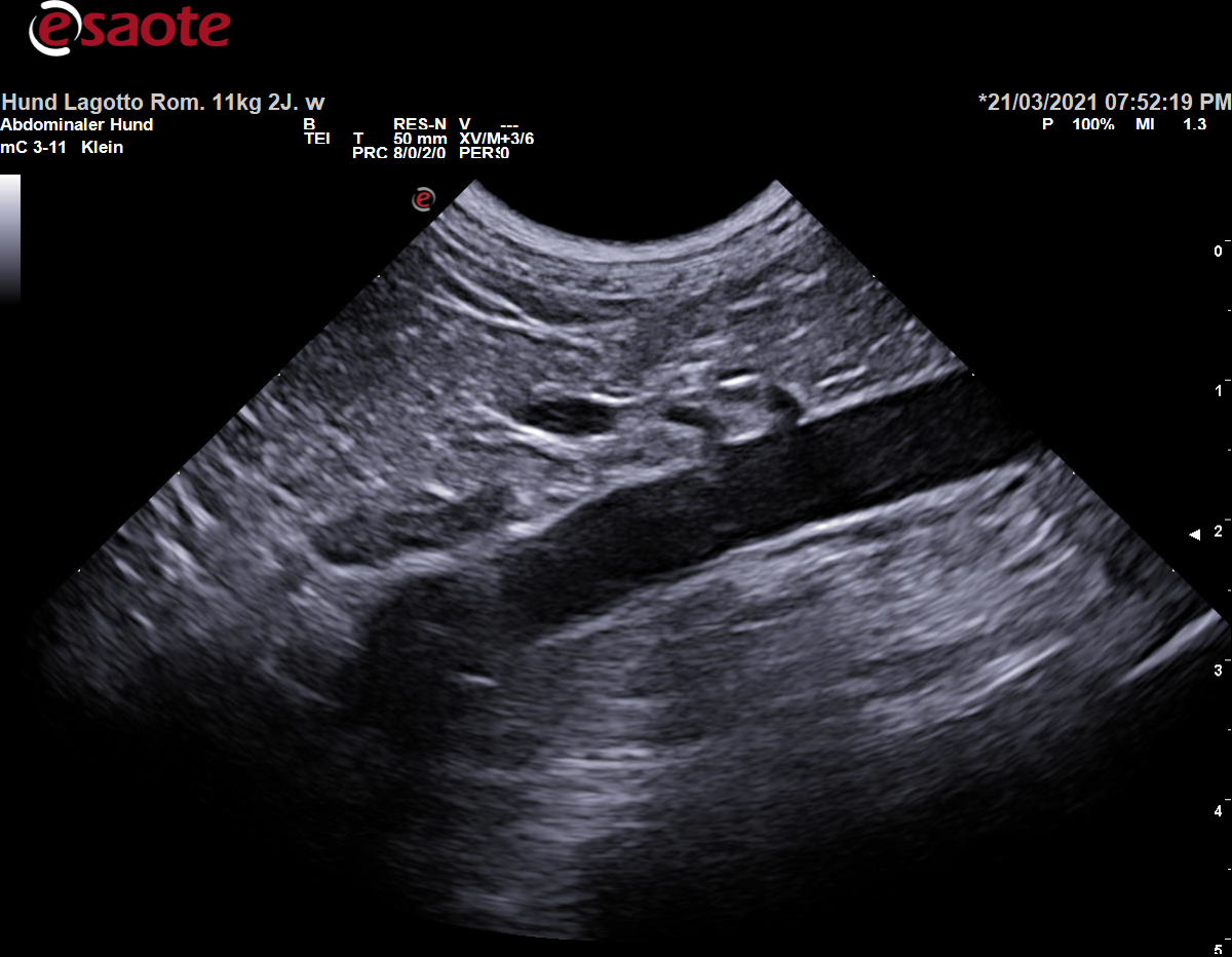 Darstellung der Abgänge der doppelt angelegten Arteriae renales auf der linken Seite (häufige Gefäßvariante) aus der Aorta abdominalis im B-Bild