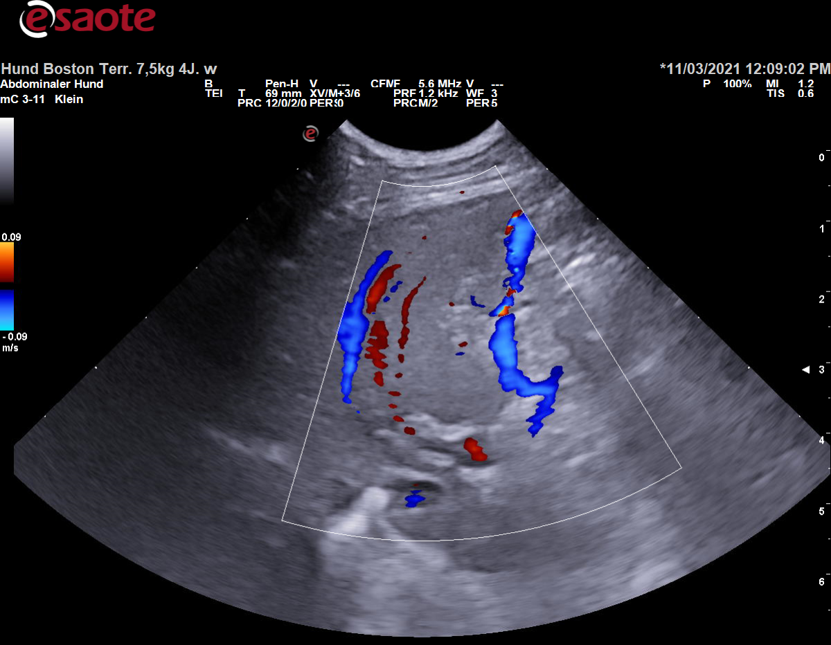 Darstellung der Vena gastroduodenalis im Verlauf Richtung Vena portae mit Zufluss der Vena gastrica dextra im Farbdoppler
