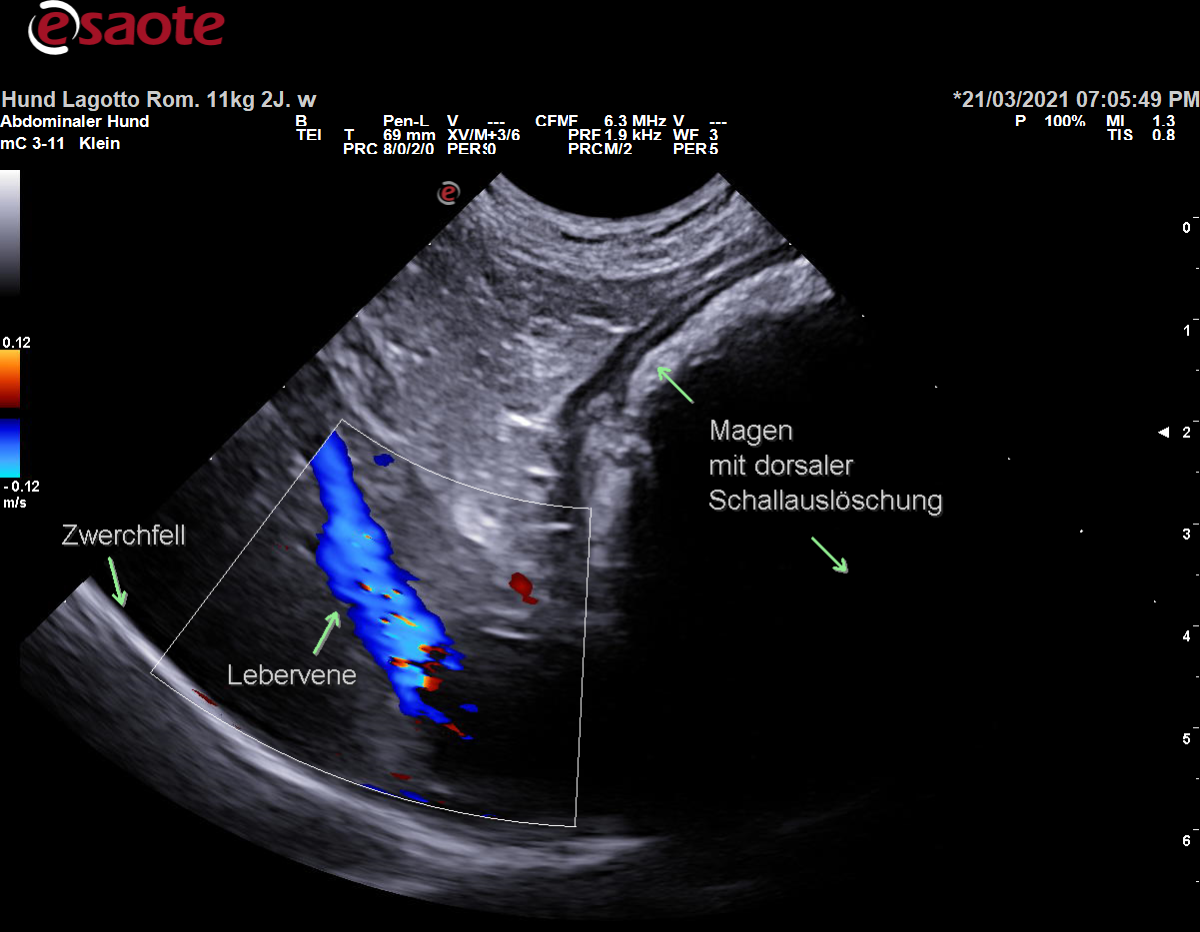 Darstellung einer Vena hepatica im Farbdoppler mit Beschriftung