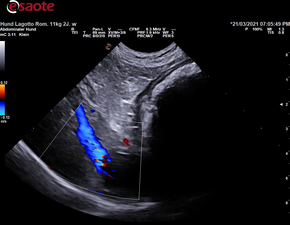 Darstellung einer Vena hepatica im Farbdoppler