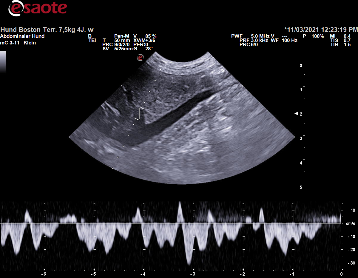 Konventionelle Duplexsonographie einer Vena hepatica mit dem PW-Doppler