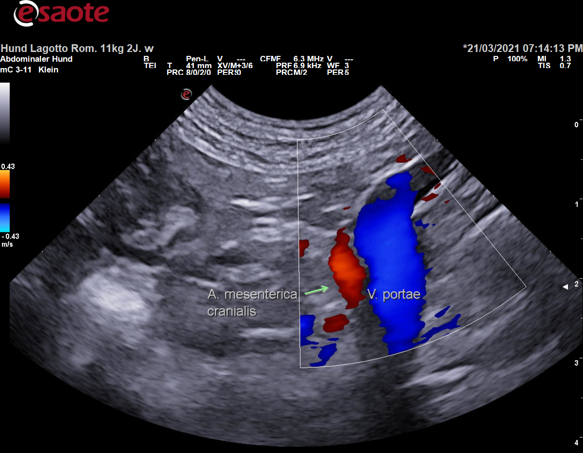 Darstellung der Vena portae im mittleren Abdomen im Farbdoppler mit Beschriftung
