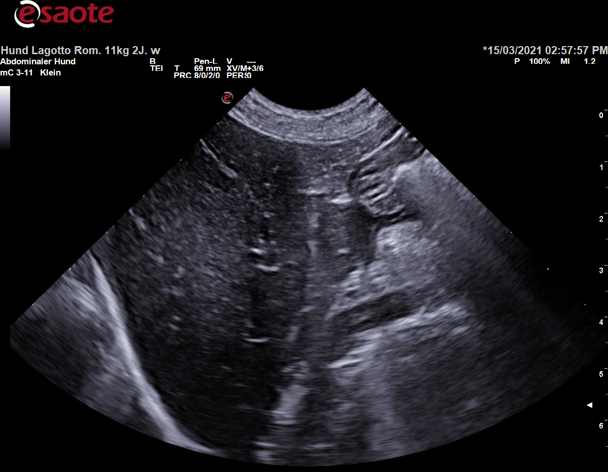 Darstellung der Vena portae auf Höhe der Porta hepatis (Leberpforte) im B-Bild