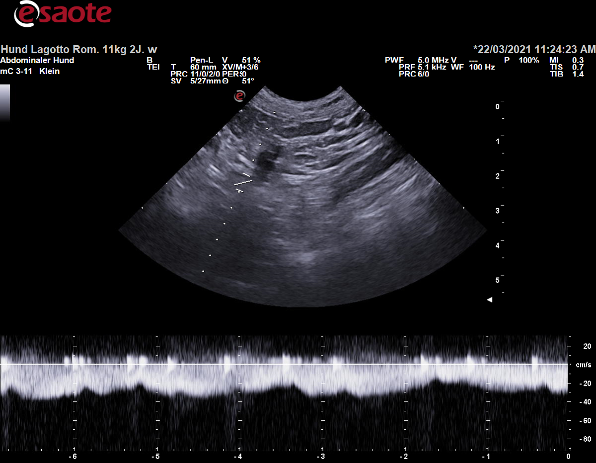 Konventionelle Duplexsonographie der Vena portae mit dem PW-Doppler