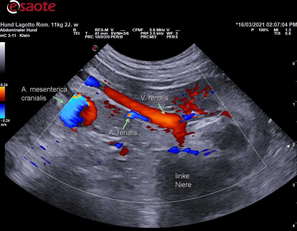 Darstellung der Vena renalis sinistra im Farbdoppler mit Beschriftung