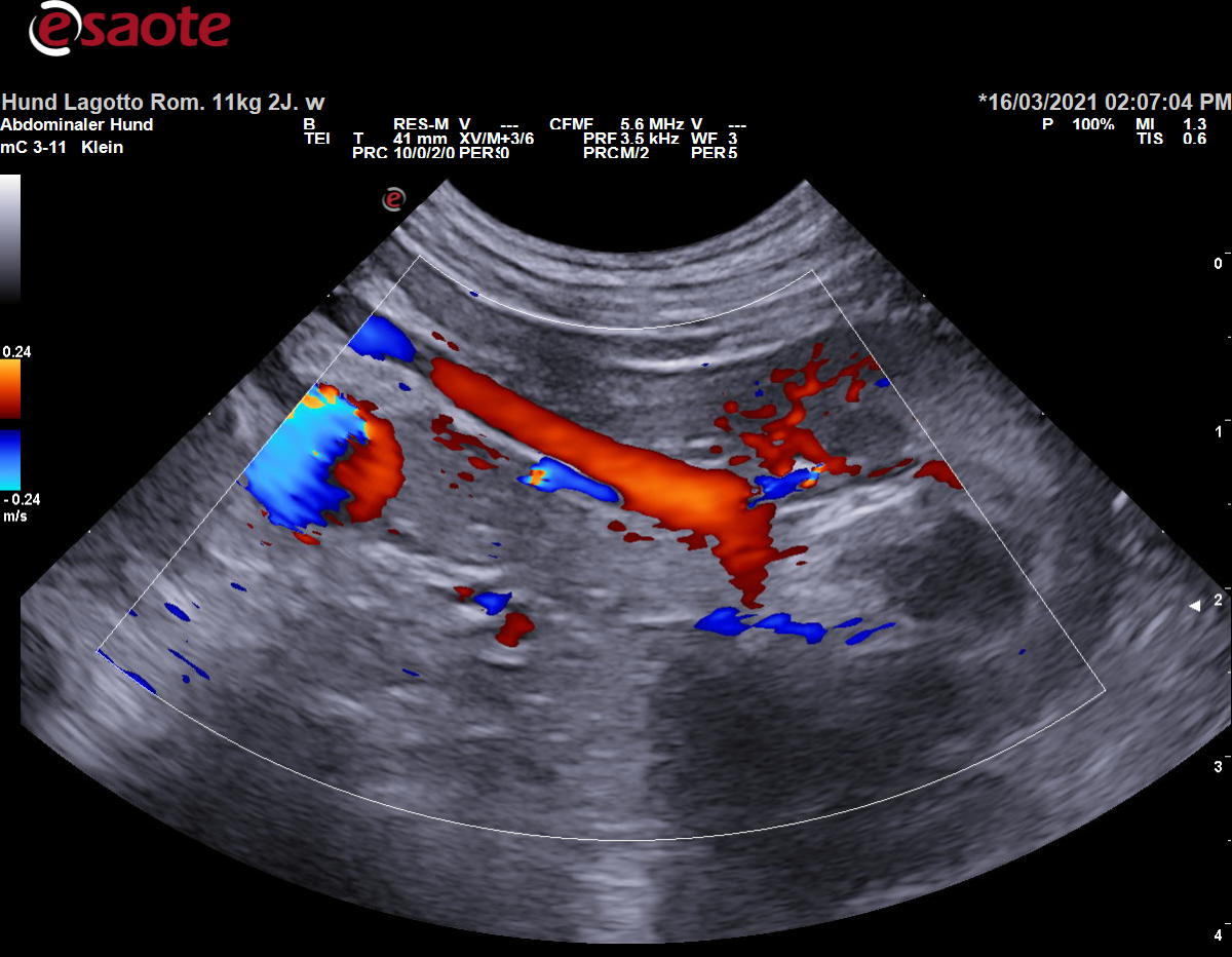 Darstellung der Vena renalis sinistra im Farbdoppler