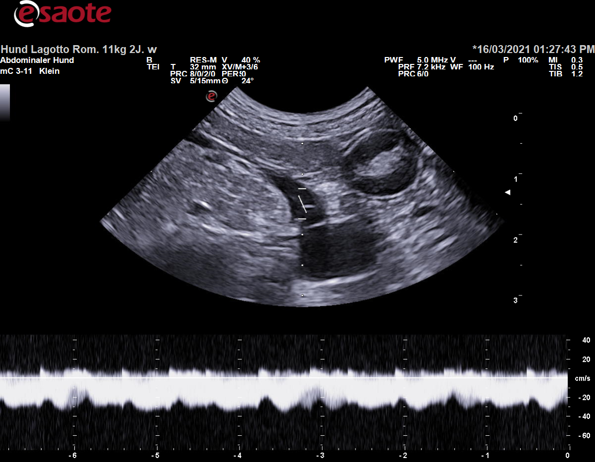 Konventionelle Duplexsonographie der Vena renalis sinistra mit dem PW-Doppler