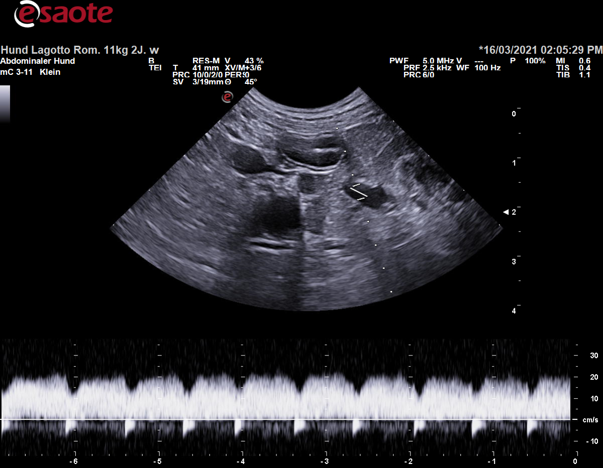 Konventionelle Duplexsonographie der Vena renalis sinistra mit dem PW-Doppler