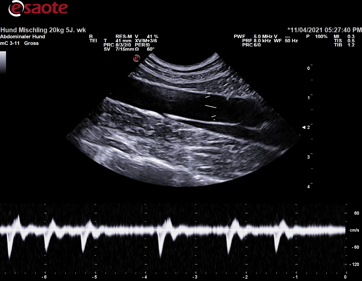 Zu niedrige Wandfilter-Einstellung für die Untersuchung der Aorta abdominalis mit dem PW-Doppler